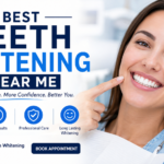 teeth whitening near me